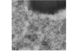 Immunogold labeling of RPE, in vivo injected With mCherry expressing vector; (mCherry 抗体)