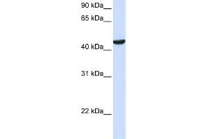 WB Suggested Anti-ZNF134 Antibody Titration: 0. (ZNF134 抗体  (Middle Region))