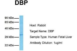Host: Rabbit Target Name: DBP Sample Tissue: Human Fetal Liver Antibody Dilution: 1. (DBP 抗体  (Middle Region))
