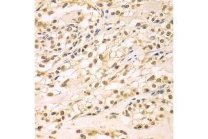 Immunohistochemistry of paraffin-embedded human kidney using TBL1XR1 antibody at dilution of 1:100 (x400 lens). (TBL1XR1 抗体)