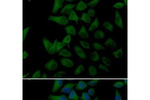 Immunofluorescence analysis of U2OS cells using PLOD2 Polyclonal Antibody (PLOD2 抗体)