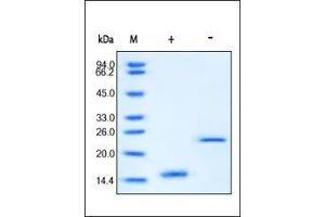 Human Activin A on SDS-PAGE under reducing (R) and no-reducing (NR) conditions. (ACVA Protein (AA 311-426))