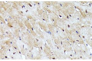 Immunohistochemistry of paraffin-embedded Mouse heart using YAP1 Polyclonal Antibody at dilution of 1:100 (40x lens). (YAP1 抗体)
