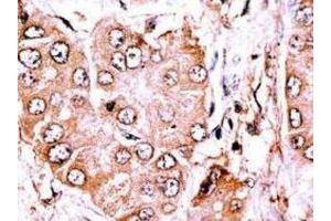 Immunohistochemistry (IHC) image for anti-Cytoplasmic Linker Associated Protein 2 (CLASP2) antibody (ABIN5023038) (CLASP2 抗体)