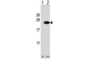 Western blot analysis of CIRBP (arrow) using rabbit polyclonal CIRBP Antibody (C-term) . (CIRBP 抗体  (C-Term))