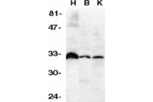 Image no. 2 for anti-Tumor Necrosis Factor Receptor Superfamily, Member 6b, Decoy (TNFRSF6B) (C-Term) antibody (ABIN202893)