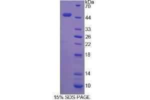 SDS-PAGE analysis of Human DCTN2 Protein. (Dynamitin 蛋白)