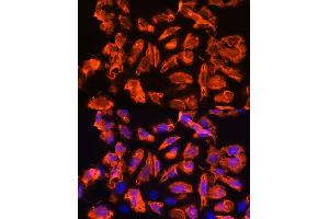 Immunofluorescence analysis of U2OS cells using TCTN1 Rabbit pAb (ABIN7270757) at dilution of 1:100. (TCTN1 抗体  (AA 130-310))