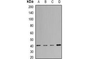 Western blot analysis of MacroH2A1 expression in Jurkat (A), Hela (B), mouse liver (C), rat lung (D) whole cell lysates. (H2AFY 抗体)