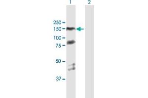 Western Blot analysis of PARP1 expression in transfected 293T cell line by PARP1 MaxPab polyclonal antibody. (PARP1 抗体  (AA 1-1014))