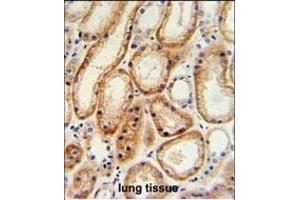GALNT5 Antibody (N-term) (ABIN653934 and ABIN2843166) IHC analysis in formalin fixed and paraffin embedded human normal lung tissue followed by peroxidase conjugation of the secondary antibody and DAB staining.