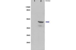 SDS-PAGE (SDS) image for anti-Tumor Susceptibility Gene 101 (TSG101) (AA 4-120) antibody (ABIN685507)