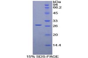 SDS-PAGE analysis of Human LILRA3 Protein. (LILRA3 蛋白)
