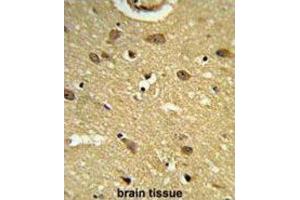Immunohistochemistry (IHC) image for anti-Ubiquitin Associated Protein 1 (UBAP1) antibody (ABIN3003932) (UBAP1 抗体)
