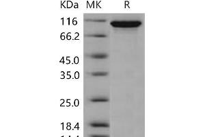 Western Blotting (WB) image for Ectonucleotide Pyrophosphatase / phosphodiesterase 2 (ENPP2) protein (His tag) (ABIN7195475)
