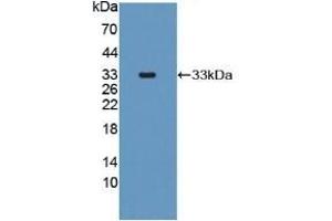 Detection of Recombinant MRP1, Human using Polyclonal Antibody to Multidrug Resistance Associated Protein 1 (MRP1) (ABCC1 抗体)