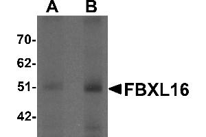 Western Blotting (WB) image for anti-F-Box and Leucine-Rich Repeat Protein 16 (FBXL16) (C-Term) antibody (ABIN1030390) (FBXL16 抗体  (C-Term))
