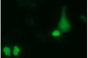 Anti-PUS7 mouse monoclonal antibody (ABIN2453555) immunofluorescent staining of COS7 cells transiently transfected by pCMV6-ENTRY PUS7 (RC203902). (PUS7 抗体)