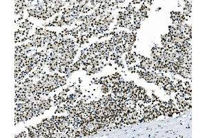 IHC analysis of HOXD11 using anti-HOXD11 antibody (ABIN7603174). (HOXD11 抗体  (N-Term))