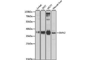 Western blot analysis of extracts of various cell lines, using SMN2 antibody (ABIN6127948, ABIN6148135, ABIN6148138 and ABIN6216175) at 1:1000 dilution. (SMN2 抗体  (AA 1-197))