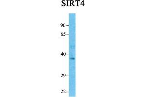 Host:  Rabbit  Target Name:  SIRT4  Sample Tissue:  Human Fetal Liver  Antibody Dilution:  1. (SIRT4 抗体  (Middle Region))