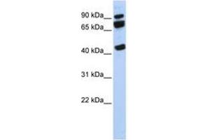 Image no. 1 for anti-DEAD (Asp-Glu-Ala-Asp) Box Polypeptide 17 (DDX17) (AA 107-156) antibody (ABIN6742675) (DDX17 抗体  (AA 107-156))