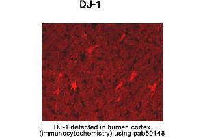 Image no. 2 for anti-Parkinson Protein 7 (PARK7) (AA 150-189), (C-Term) antibody (ABIN363457) (PARK7/DJ1 抗体  (C-Term))