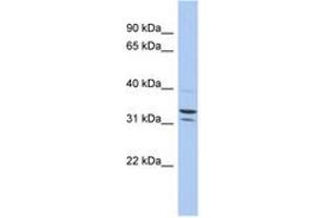 Image no. 1 for anti-Family with Sequence Similarity 92, Member B (FAM92B) (AA 71-120) antibody (ABIN6743910) (FAM92B 抗体  (AA 71-120))