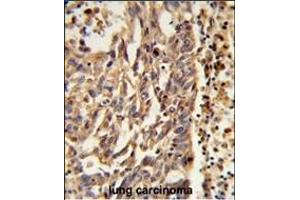 Immunohistochemistry (Paraffin-embedded Sections) (IHC (p)) image for anti-Kinesin Family Member 11 (KIF11) (AA 103-130), (N-Term) antibody (ABIN653041)