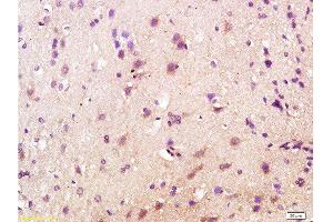 Formalin-fixed and paraffin embedded rat brain labeled with Anti-CD200R/Orexin receptor Polyclonal Antibody, Unconjugated  at 1:200 followed by conjugation to the secondary antibody and DAB staining. (OX1R/OX2R 抗体  (AA 321-425))