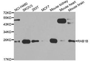Western blot analysis of extracts of various cell lines, using RAB1B antibody. (RAB1B 抗体)