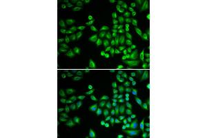 Immunofluorescence (IF) image for anti-Protein tyrosine Phosphatase, Non-Receptor Type 1 (PTPN1) antibody (ABIN1980139) (PTPN1 抗体)