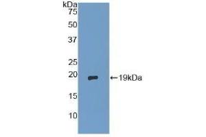 Detection of Recombinant dSIP, Human using Polyclonal Antibody to Delta-Sleep Inducing Peptide (dSIP) (TSC22D3 抗体  (AA 1-134))