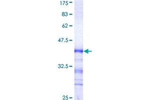 CDK13 Protein (AA 1-90) (GST tag)