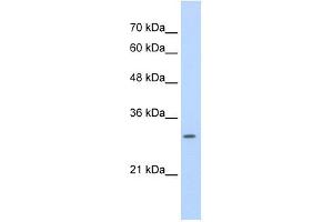 SLBP antibody used at 0.