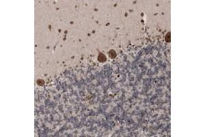 Immunohistochemical staining of human cerebellum with SOWAHB polyclonal antibody  shows strong cytoplasmic and nuclear positivity in Purkinje cells and molecular layer. (SOWAHB 抗体)
