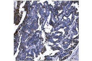 IHC analysis of GSDMD using anti-GSDMD antibody (ABIN7599433).