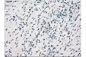 Immunohistochemical staining of paraffin-embedded Ovary tissue using anti-RAD9Amouse monoclonal antibody. (RAD9A 抗体)
