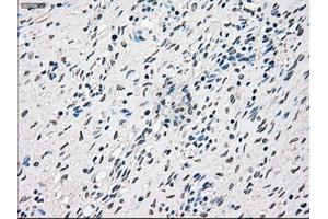 Immunohistochemical staining of paraffin-embedded Ovary tissue using anti-RAD9Amouse monoclonal antibody.