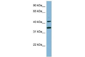 BLNK antibody used at 1 ug/ml to detect target protein. (B-Cell Linker 抗体  (Middle Region))
