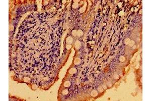 Immunohistochemistry of paraffin-embedded human small intestine tissue using ABIN7169226 at dilution of 1:100 (WNK2 抗体  (AA 1177-1464))