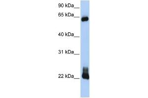 RHOD antibody used at 1 ug/ml to detect target protein. (RHOD 抗体  (C-Term))