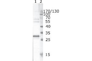 Western Blot testing of HIV-1 recombinant Nef protein. (HIV-1 Nef (AA 195-205) 抗体)