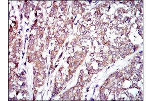 Image no. 1 for anti-V-Raf-1 Murine Leukemia Viral Oncogene Homolog 1 (RAF1) antibody (ABIN1500582) (RAF1 抗体)