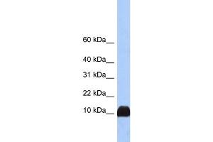 WB Suggested Anti-PFN1 Antibody Titration:  0. (PFN1 抗体  (N-Term))