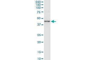 CTH monoclonal antibody (M01), clone 4E1-1B7. (CTH 抗体  (AA 1-405))
