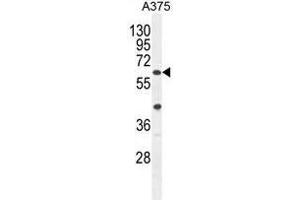 ACF Antibody (C-term) western blot analysis in A375 cell line lysates (35ug/lane). (A1CF 抗体  (C-Term))
