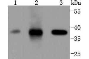 Lane 1: Jurkat, Lane 2: K562, Lane 3: Hela lysates probed with Cdk6 (4F7) Monoclonal Antibody  at 1:1000 overnight at 4˚C. (CDK6 抗体)