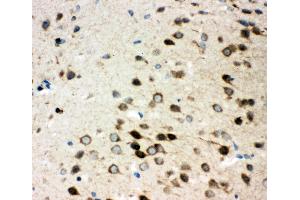 Anti-Integrin alpha 3 antibody, IHC(P) IHC(P): Rat Brain Tissue (ITGA3 抗体  (N-Term))
