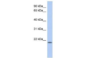 WB Suggested Anti-CHAC2 Antibody Titration: 0. (CHAC2 抗体  (N-Term))